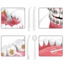 Kép 9/10 - Dental Flosser vezeték nélküli akkus fogászati erőteljes tisztító 4 fúvóka 3 mód, 230ml